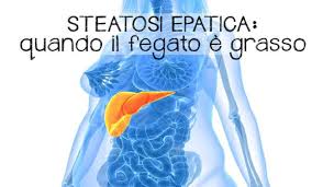 Steatosi epatica o fegato grasso e alimentazione